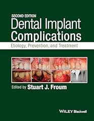 Dental implant complications for sale  Delivered anywhere in USA 