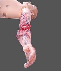 Incomplete arm amputation for sale  Delivered anywhere in USA 
