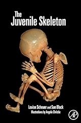 The juvenile skeleton gebraucht kaufen  Wird an jeden Ort in Deutschland