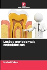 Lesões periodontais endodônt usato  Spedito ovunque in Italia 