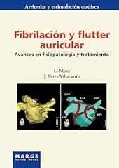 Fibrilación flutter auricular d'occasion  Livré partout en France