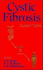 Cystic fibrosis current d'occasion  Livré partout en France
