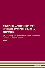 Reversing christ siemens d'occasion  Livré partout en France