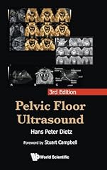 Pelvic floor ultrasound for sale  Delivered anywhere in USA 