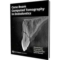 Cone beam computed for sale  Delivered anywhere in Ireland