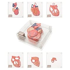 Anatomic heart specimen for sale  Delivered anywhere in USA 