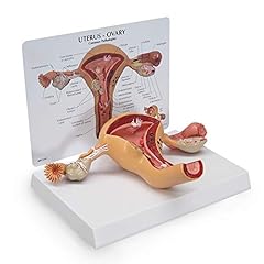 Gpi anatomicals uterus for sale  Delivered anywhere in USA 