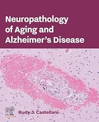 Neuropathology aging alzheimer for sale  Delivered anywhere in UK
