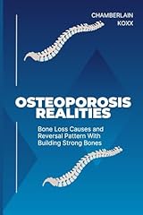 Osteoporosis realities bone d'occasion  Livré partout en France