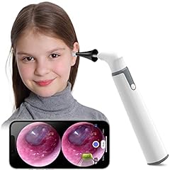 Wireless otoscope ear for sale  Delivered anywhere in USA 