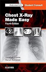 Chest ray made for sale  Delivered anywhere in USA 