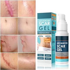 Scar cream advance for sale  Delivered anywhere in USA 