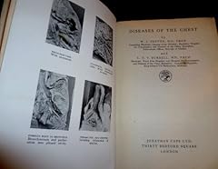 Diseases chest illustrations for sale  Delivered anywhere in UK