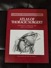 Atlas thoracic surgery for sale  Delivered anywhere in USA 