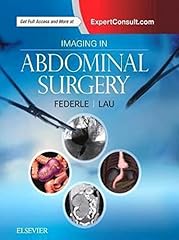 Imaging abdominal surgery for sale  Delivered anywhere in USA 