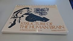 Structure human brain for sale  Delivered anywhere in UK