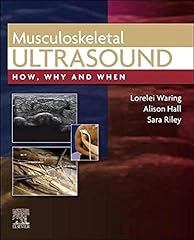 Musculoskeletal ultrasound for sale  Delivered anywhere in UK