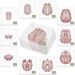 Timethink brain specimen for sale  Delivered anywhere in USA 