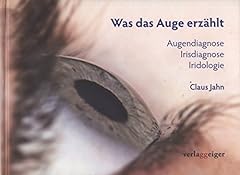Auge erzählt augendiagnose gebraucht kaufen  Wird an jeden Ort in Deutschland