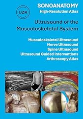 Sonoanatomy high resolution for sale  Delivered anywhere in UK