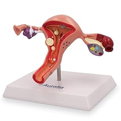 Modèle anatomie utérus d'occasion  Livré partout en France