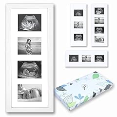 Baby ultrasound picture for sale  Delivered anywhere in USA 