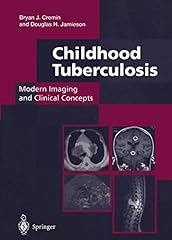 Childhood tuberculosis modern d'occasion  Livré partout en France