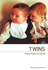 Twins from fetus d'occasion  Livré partout en Belgiqu
