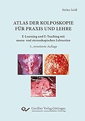 Atlas kolposkopie praxis gebraucht kaufen  Wird an jeden Ort in Deutschland