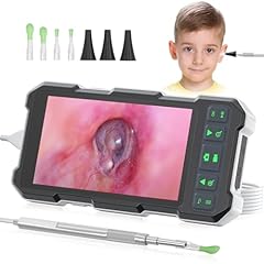 Video otoscope camera for sale  Delivered anywhere in USA 