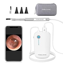 Teslong otoscope video for sale  Delivered anywhere in USA 