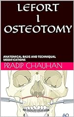 Lefort osteotomy anatomical usato  Spedito ovunque in Italia 
