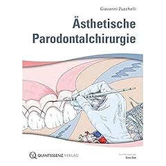 ästhetische parodontalchirurg usato  Spedito ovunque in Italia 