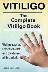 Vitiligo. vitiligo causes d'occasion  Livré partout en France