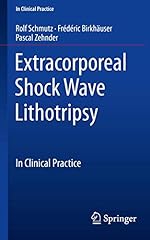 Extracorporeal shock wave for sale  Delivered anywhere in USA 