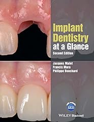 Implant dentistry glance for sale  Delivered anywhere in UK