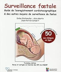 Surveillance foetale guide usato  Spedito ovunque in Italia 