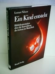 Lennart nilsson kind gebraucht kaufen  Wird an jeden Ort in Deutschland