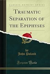 Traumatic separation the gebraucht kaufen  Wird an jeden Ort in Deutschland