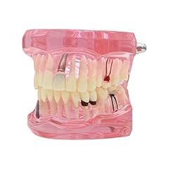Dentalmall teeth model for sale  Delivered anywhere in USA 