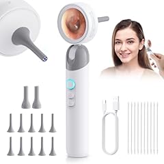 Aertnelz otoscope ear for sale  Delivered anywhere in USA 