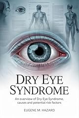Dry eye syndrome usato  Spedito ovunque in Italia 