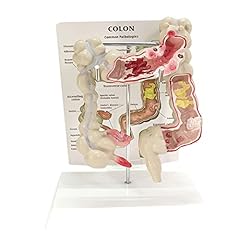 Hpthly patologia umana usato  Spedito ovunque in Italia 