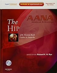 Aana advanced arthroscopy for sale  Delivered anywhere in USA 