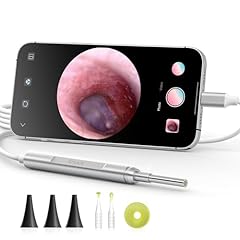 Anykit digital otoscope for sale  Delivered anywhere in USA 