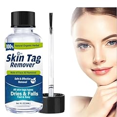 Skin tag remover for sale  Delivered anywhere in Ireland