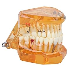 Modèle étude dents d'occasion  Livré partout en France