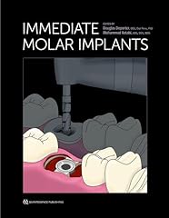 Immediate molar implants gebraucht kaufen  Wird an jeden Ort in Deutschland