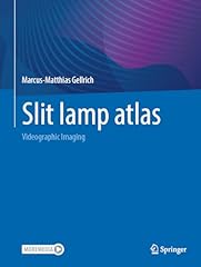 Slit lamp atlas gebraucht kaufen  Wird an jeden Ort in Deutschland