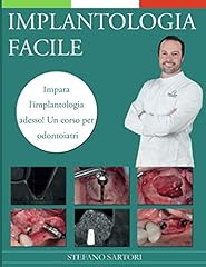 Implantologia facile impara usato  Spedito ovunque in Italia 